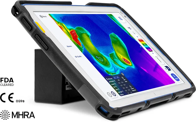 Thermidas IRT-384 thermal imaging tablet showing a foot scan with temperature analysis